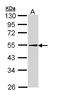 Perilipin-2 antibody, LS-B4850, Lifespan Biosciences, Western Blot image 
