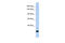 Zinc Finger Protein 197 antibody, 25-289, ProSci, Enzyme Linked Immunosorbent Assay image 