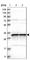 Mitochondrial Ribosomal Protein L45 antibody, HPA023385, Atlas Antibodies, Western Blot image 