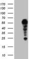 SET Domain Containing 2, Histone Lysine Methyltransferase antibody, NBP2-45791, Novus Biologicals, Western Blot image 