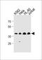 Mitochondrial Trans-2-Enoyl-CoA Reductase antibody, PA5-35243, Invitrogen Antibodies, Western Blot image 