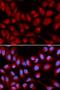 Pro-interleukin-16 antibody, LS-C335177, Lifespan Biosciences, Immunofluorescence image 