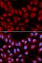 Interleukin 16 antibody, LS-C335177, Lifespan Biosciences, Immunofluorescence image 