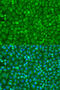 Eukaryotic Translation Initiation Factor 4E antibody, 18-547, ProSci, Immunofluorescence image 