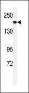 Alpha-2-Macroglobulin Like 1 antibody, 61-639, ProSci, Western Blot image 