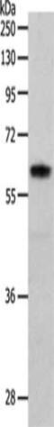 P21 (RAC1) Activated Kinase 1 antibody, CSB-PA116147, Cusabio, Western Blot image 