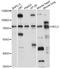 Solute Carrier Family 37 Member 2 antibody, LS-C749462, Lifespan Biosciences, Western Blot image 