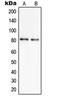Solute Carrier Family 6 Member 17 antibody, orb215424, Biorbyt, Western Blot image 