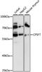Cleavage And Polyadenylation Specific Factor 7 antibody, LS-C748901, Lifespan Biosciences, Western Blot image 