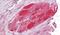 STIP1 Homology And U-Box Containing Protein 1 antibody, PA5-18011, Invitrogen Antibodies, Immunohistochemistry paraffin image 