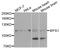 Wolframin ER Transmembrane Glycoprotein antibody, MBS126473, MyBioSource, Western Blot image 