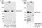 Protein Phosphatase, Mg2+/Mn2+ Dependent 1G antibody, A300-881A, Bethyl Labs, Western Blot image 