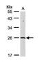 SUMO Peptidase Family Member, NEDD8 Specific antibody, PA5-29141, Invitrogen Antibodies, Western Blot image 