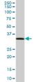 Eukaryotic Translation Elongation Factor 1 Delta antibody, H00001936-M04, Novus Biologicals, Western Blot image 