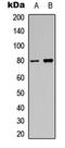Protein Kinase C Alpha antibody, LS-C368483, Lifespan Biosciences, Western Blot image 