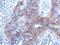 Brevican antibody, GTX119374, GeneTex, Immunohistochemistry paraffin image 