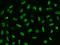 Serine/Arginine Repetitive Matrix 2 antibody, 204648-T02, Sino Biological, Immunohistochemistry paraffin image 