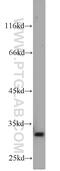 Heme Oxygenase 1 antibody, 10701-1-AP, Proteintech Group, Western Blot image 