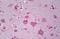 Par-3 Family Cell Polarity Regulator antibody, MBS247081, MyBioSource, Immunohistochemistry paraffin image 