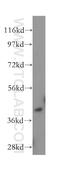 C-C Motif Chemokine Receptor 2 antibody, 16153-1-AP, Proteintech Group, Western Blot image 