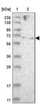 Zinc Finger Protein 274 antibody, PA5-56001, Invitrogen Antibodies, Western Blot image 