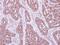 NADH:Ubiquinone Oxidoreductase Subunit S5 antibody, NBP2-19506, Novus Biologicals, Immunohistochemistry frozen image 