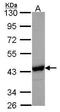 N-Acetylneuraminate Synthase antibody, TA307925, Origene, Western Blot image 