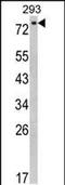 EPS8 Like 3 antibody, PA5-49599, Invitrogen Antibodies, Western Blot image 