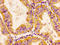 Chordin Like 1 antibody, LS-C674642, Lifespan Biosciences, Immunohistochemistry paraffin image 