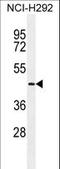 Transmembrane Serine Protease 11E antibody, LS-B13210, Lifespan Biosciences, Western Blot image 