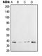 X-Ray Repair Cross Complementing 3 antibody, LS-C353014, Lifespan Biosciences, Western Blot image 