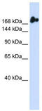 Nucleoporin 98 antibody, TA345202, Origene, Western Blot image 