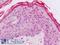 Ubiquitin Conjugating Enzyme E2 D1 antibody, LS-B8983, Lifespan Biosciences, Immunohistochemistry paraffin image 