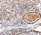 DNA Methyltransferase 3 Alpha antibody, A00136-1, Boster Biological Technology, Immunohistochemistry paraffin image 