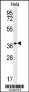 Interleukin 24 antibody, 62-096, ProSci, Western Blot image 