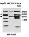 Zinc Finger MYM-Type Containing 5 antibody, orb77938, Biorbyt, Western Blot image 