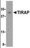 TIR Domain Containing Adaptor Protein antibody, MBS395622, MyBioSource, Western Blot image 