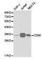 CD99 Molecule (Xg Blood Group) antibody, LS-C192832, Lifespan Biosciences, Western Blot image 