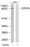 Signal Transducer And Activator Of Transcription 4 antibody, 79-288, ProSci, Western Blot image 