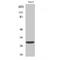 Acyl-CoA Binding Domain Containing 6 antibody, LS-C381869, Lifespan Biosciences, Western Blot image 