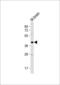 Pregnancy Specific Beta-1-Glycoprotein 3 antibody, 64-002, ProSci, Western Blot image 