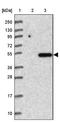 Transmembrane Protein 39A antibody, NBP1-83813, Novus Biologicals, Western Blot image 