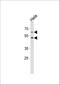 Fucosyltransferase 8 antibody, A04453, Boster Biological Technology, Western Blot image 