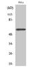 Zinc Finger Protein 397 antibody, GTX34309, GeneTex, Western Blot image 