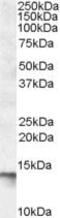 C1D Nuclear Receptor Corepressor antibody, PA5-19053, Invitrogen Antibodies, Western Blot image 