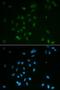 Checkpoint Kinase 2 antibody, LS-C331943, Lifespan Biosciences, Immunofluorescence image 