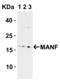 Mesencephalic Astrocyte Derived Neurotrophic Factor antibody, 4347, ProSci Inc, Western Blot image 