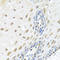 ElaC Ribonuclease Z 2 antibody, LS-C346390, Lifespan Biosciences, Immunohistochemistry frozen image 