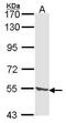 Tripeptidyl Peptidase 1 antibody, TA308202, Origene, Western Blot image 