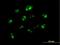 Nucleophosmin/Nucleoplasmin 3 antibody, H00010360-B01P, Novus Biologicals, Immunocytochemistry image 